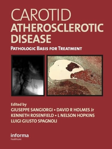 Carotid Atherosclerotic Disease: Pathologic Basis for Treatment