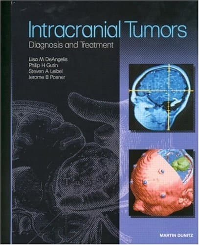 Intracranial Tumors: Diagnosis and Treatment