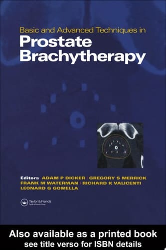 Basic and Advanced Techniques in Prostate Brachytherapy