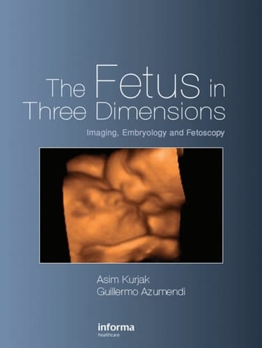 Fetus in Three Dimensions: Imaging, Embryology and Fetoscopy