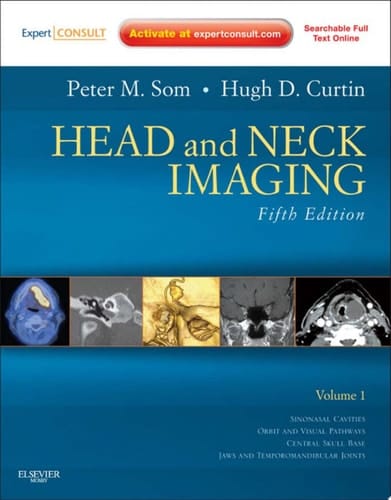 Head and Neck Imaging E-Book Head and Neck Imaging E-Book