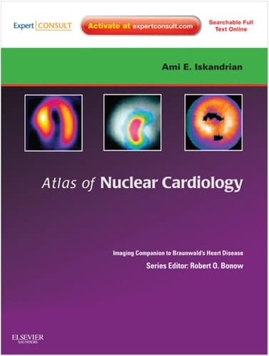 Atlas of Nuclear Cardiology: Imaging Companion to Braunwald's Heart Disease E-Book