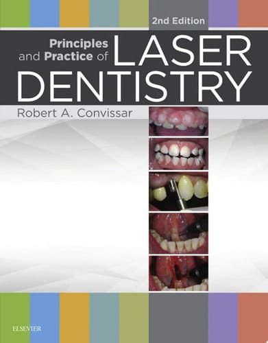 Principles and Practice of Laser Dentistry