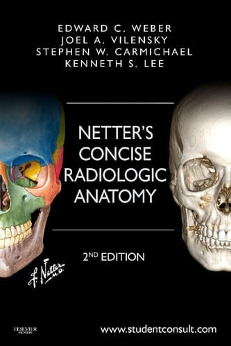 Netter's Concise Radiologic Anatomy Elsevier eBook on Intel Education Study (Retail Access Card) (Netter Basic Science)