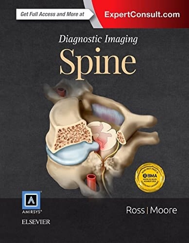 Diagnostic Imaging Spine