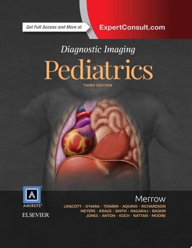 Diagnostic Imaging: Pediatrics E-Book Diagnostic Imaging: Pediatrics E-Book