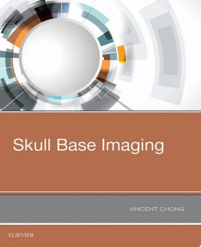 Skull Base Imaging