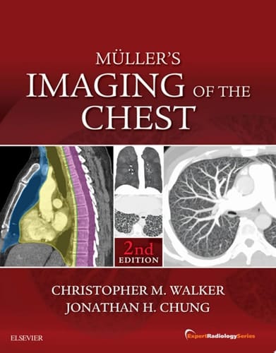 Muller's Imaging of the Chest E-Book Expert Radiology Series