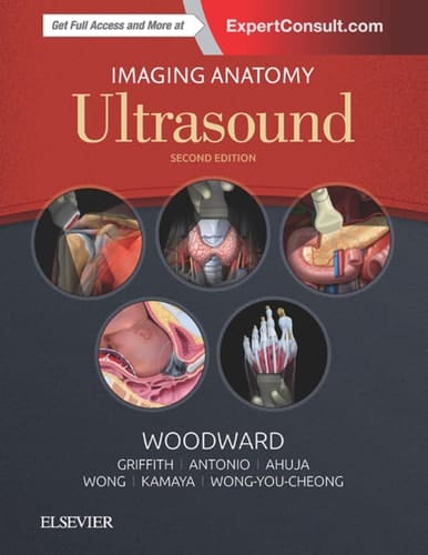 Imaging Anatomy: Ultrasound