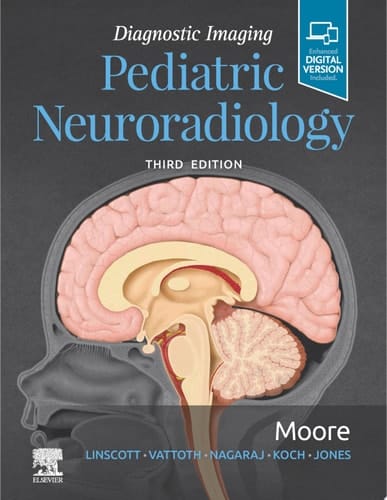 Diagnostic Imaging: Pediatric Neuroradiology E-Book Diagnostic Imaging: Pediatric Neuroradiology E-Book