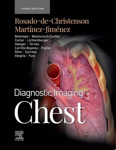 Diagnostic Imaging: Chest