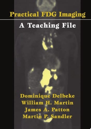 Practical FDG Imaging