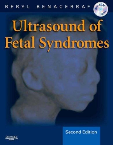 Ultrasound of fetal syndromes