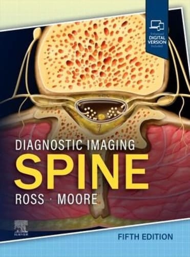 Diagnostic Imaging: Spine