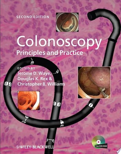Colonoscopy Principles and Practice