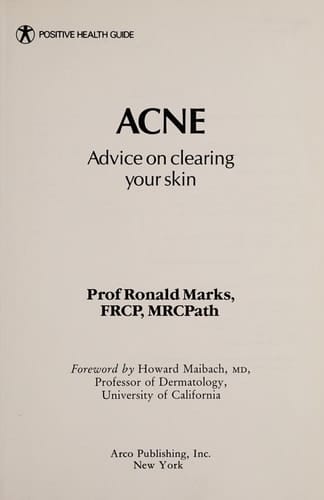 Acne Advice on Clearing Your Skin