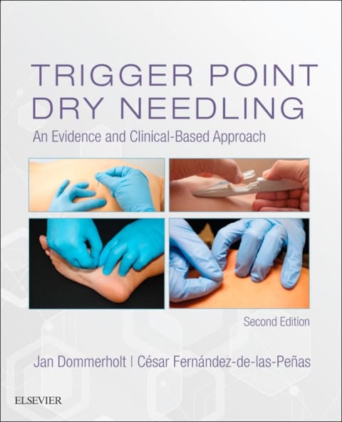 Trigger Point Dry Needling - Elsevier E-Book on VitalSource