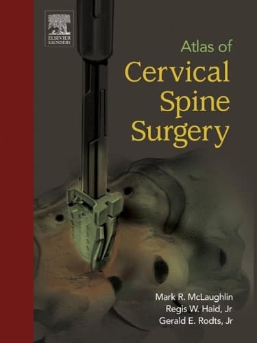 Atlas of Cervical Spine Surgery