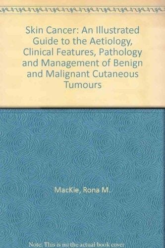 Skin Cancer: An Illustrated Guide to the Aetiology, Clinical Features, Pathology and Management of Benign and Malignant Cutaneous Tumours