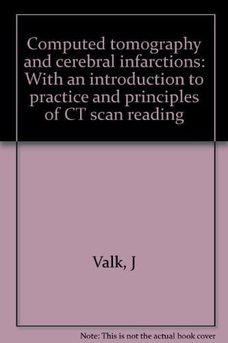 Computed Tomography and Cerebral Infarctions With an Introduction to Practice and Principles of CT Scan Reading