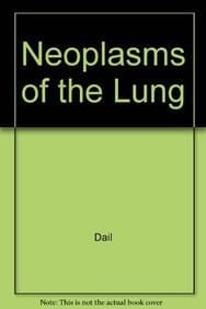 Neoplasms of the Lung Based on the Proceedings of the 57th Annual Anatomic Pathology Slide Seminar of the American Society of Clinical Pathologists : September 26 and 27, 1991, New Orleans, Louisiana
