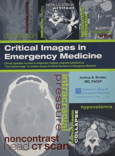Critical Images in Emergency Medicine Clinical Vignettes Focused on Diagnostic Imaging...