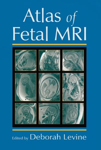 Atlas of Fetal MRI