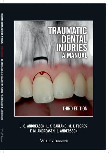 Traumatic Dental Injuries A Manual