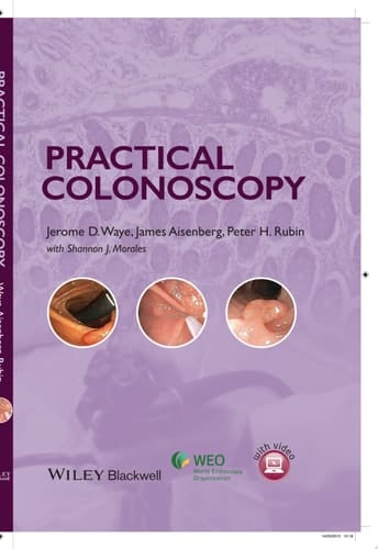 Practical Colonoscopy