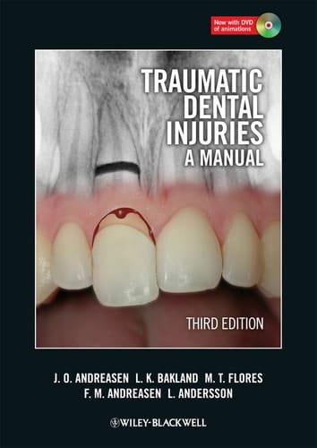 Traumatic Dental Injuries A Manual