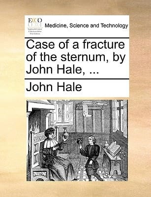 Case of a fracture of the sternum, by John Hale, ...