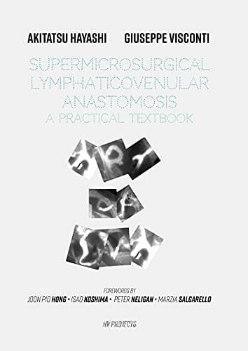 Supermicrosurgical LymphaticoVenular Anastomosis A Practical Textbook. : LVA Textbook