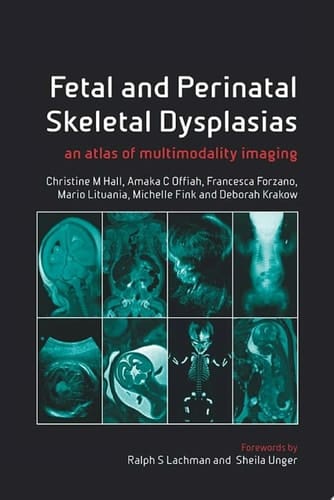 Fetal and Perinatal Skeletal Dysplasias an Atlas of Multimodality Imaging
