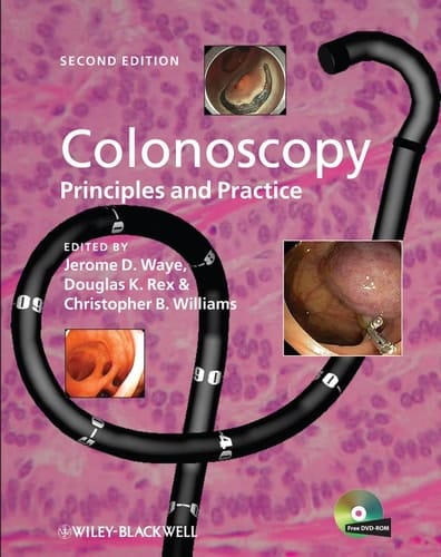 Colonoscopy Principles and Practice