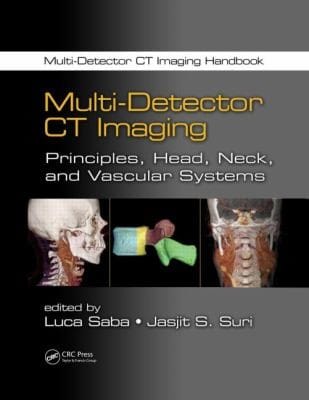 Multidetector Ct Imaging