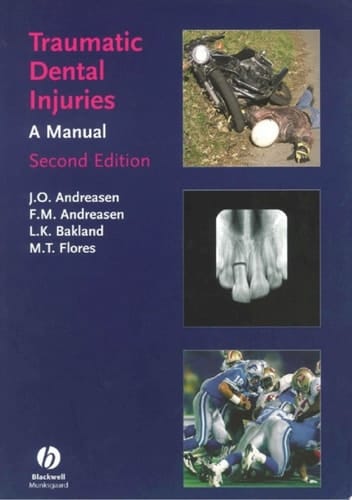 Traumatic Dental Injuries A Manual