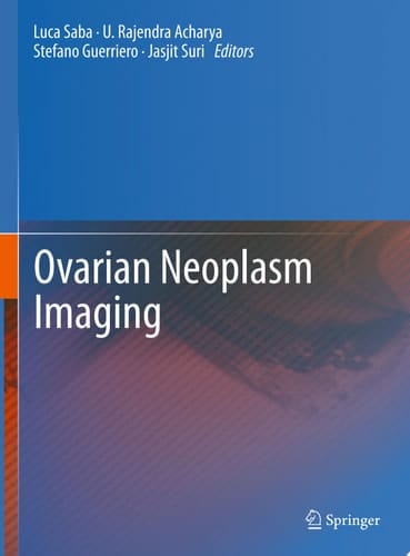 Ovarian Neoplasm Imaging