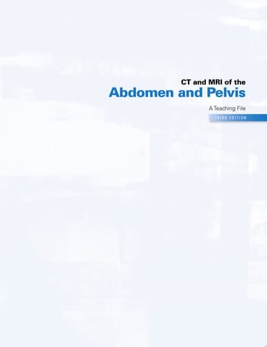 CT & MRI of the Abdomen and Pelvis A Teaching File