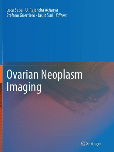 Ovarian Neoplasm Imaging