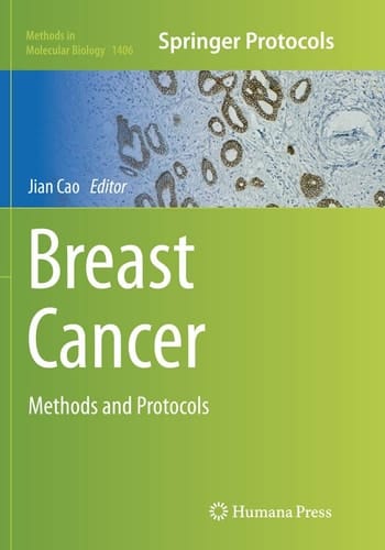 Breast Cancer Methods and Protocols