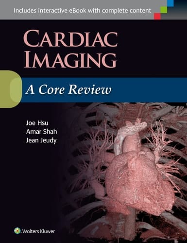 Cardiac Imaging A Core Review