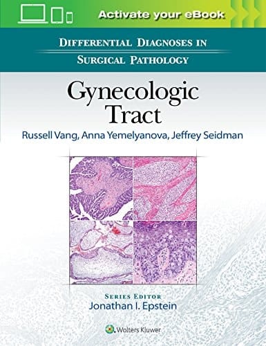Gynecologic Tract