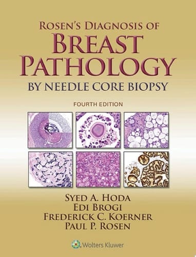 Rosen's Diagnosis of Breast Pathology by Needle Core Biopsy