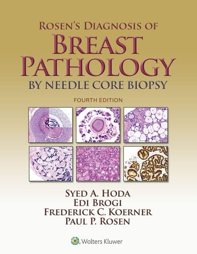 Rosen's Diagnosis of Breast Pathology by Needle Core Biopsy
