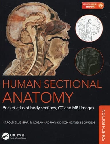 Human Sectional Anatomy Pocket Atlas of Body Sections, CT and MRI Images, Fourth Edition