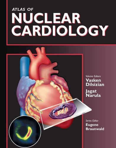 Atlas of Nuclear Cardiology