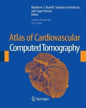 Atlas of Cardiovascular Computed Tomography: includes narrated videos
