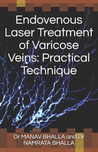 Endovenous Laser Treatment of Varicose Veins Practical Technique