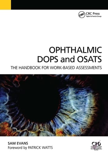 Ophthalmic DOPS and OSATS The Handbook for Work-based Assessments