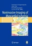 Noninvasive Imaging of Myocardial Ischemia